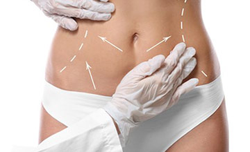 جراحی زیبایی شکم یا ابدومینوپلاستی چیست