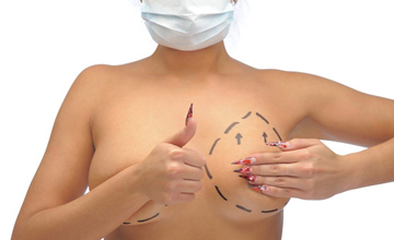 ماستوپکسی جراحی لیفت سینه