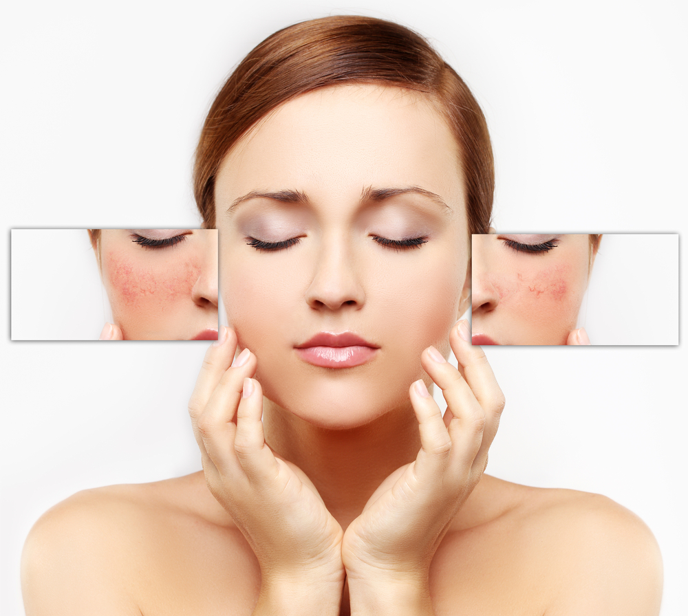 موارد استفاده از روش میکرودرم