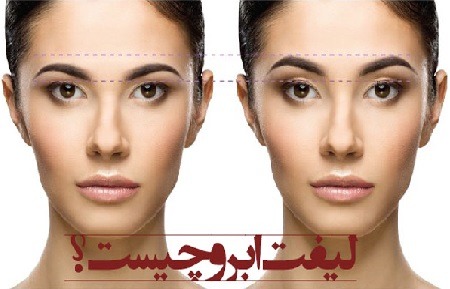 لیفت ابرو با نخ