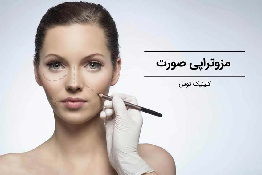 مزوتراپی صورت