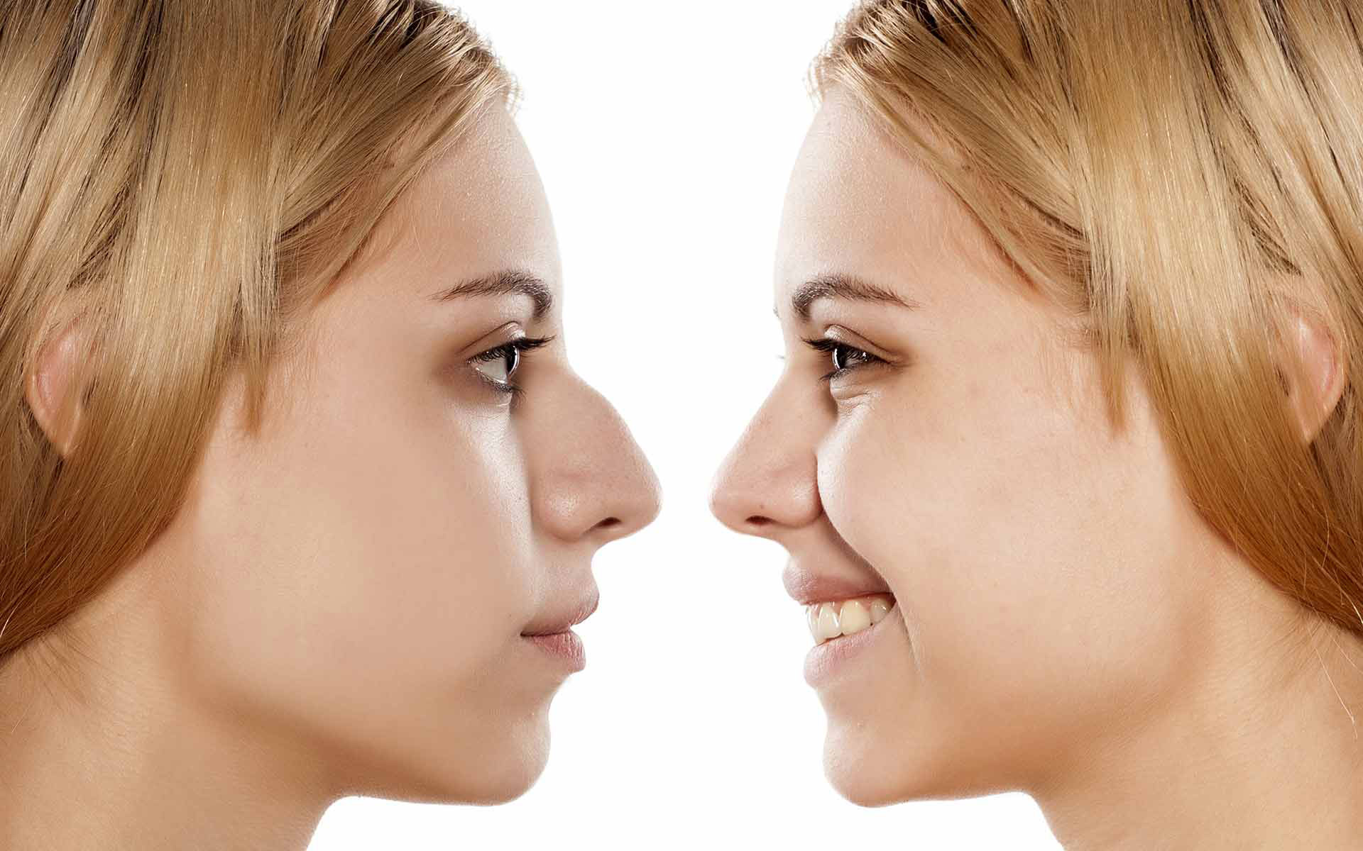 سؤالات متداول در مورد جراحی زیبایی بینی